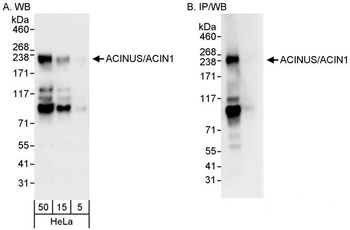 Rabbit anti-ACINUS/ACN1 Antibody