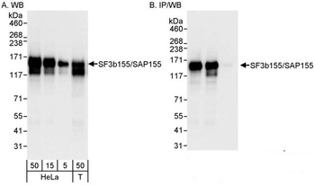 SF3b155/SAP155 Antibody