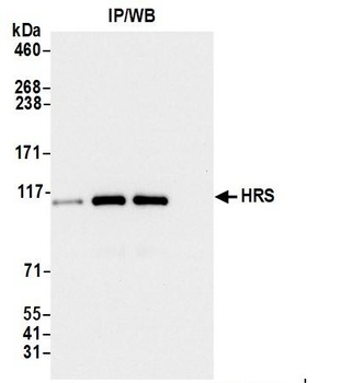 Rabbit HRS Antibody