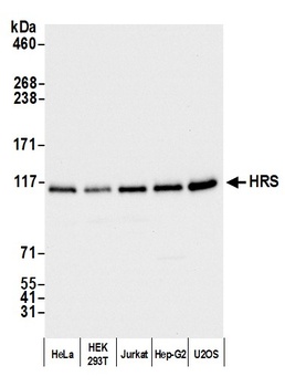Rabbit HRS Antibody