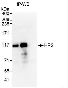 Rabbit HRS Antibody