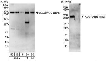 Rabbit ACC1/ACC-alpha Antibody