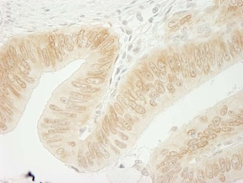 Rabbit CTNND1 Antibody