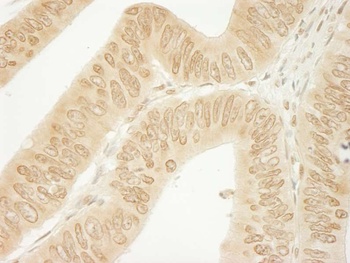 Rabbit CTNND1 Antibody