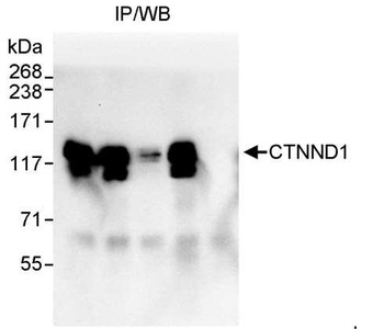 CTNND1 Antibody