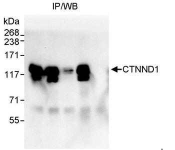 Rabbit CTNND1 Antibody