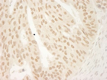 Rabbit CTNND1 Antibody
