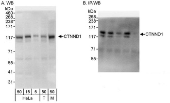 Rabbit CTNND1 Antibody