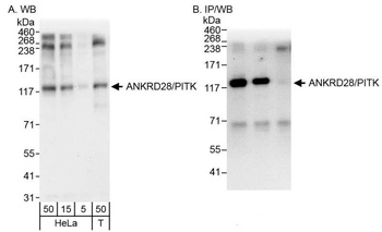 ANKRD28/PITK Antibody
