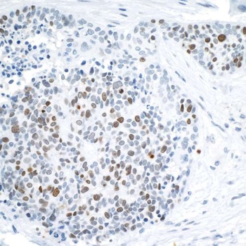 Rabbit anti-FALZ/BPTF Antibody