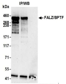 Rabbit anti-FALZ/BPTF Antibody
