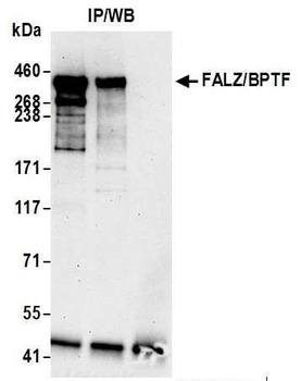 FALZ/BPTF Antibody
