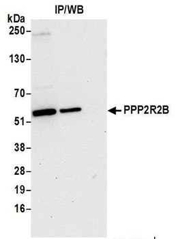 PPP2R2B Antibody