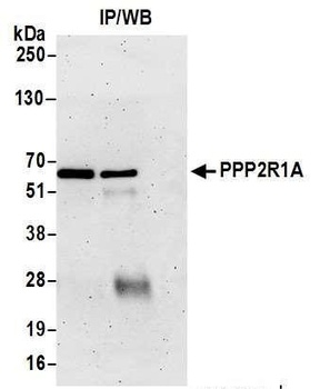 PPP2R1A Antibody