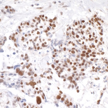 Rabbit anti-Timeless Antibody
