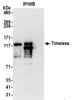Rabbit anti-Timeless Antibody