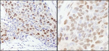 Rabbit anti-RbBP7 Antibody