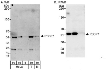 Rabbit anti-RbBP7 Antibody