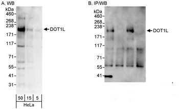 Rabbit anti-DOT1L Antibody