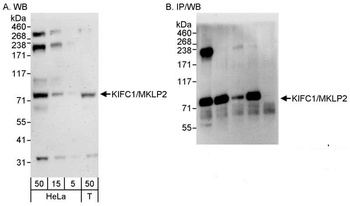 Rabbit anti-KIFC1/MKLP2 Antibody
