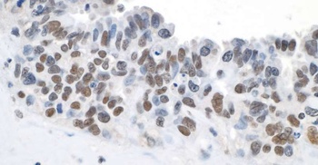 Topo II Beta Antibody