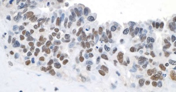 Rabbit anti-Topo II Beta Antibody