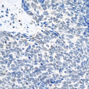 Rabbit anti-Topo II Beta Antibody