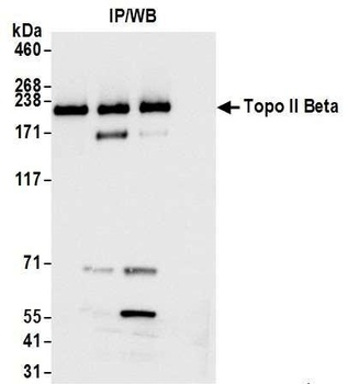 Rabbit anti-Topo II Beta Antibody