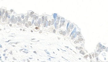Rabbit anti-Topo II Beta Antibody