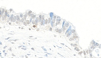 Topo II Beta Antibody