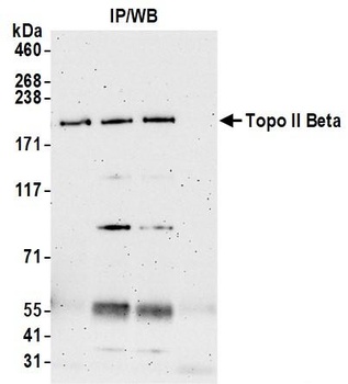 Topo II Beta Antibody