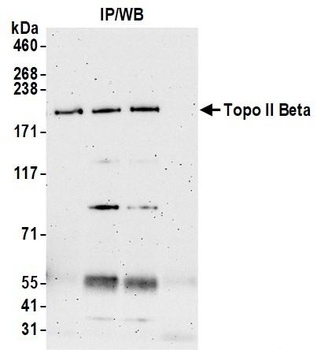 Rabbit anti-Topo II Beta Antibody