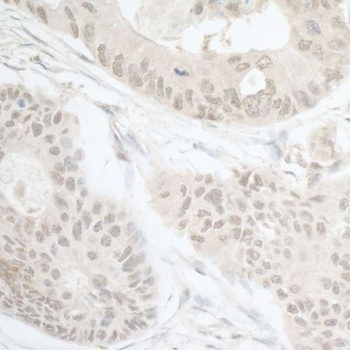Rabbit anti-DTL/CDT2 Antibody