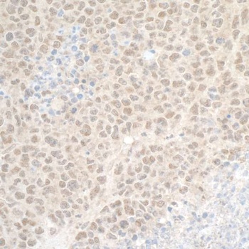 Rabbit anti-DTL/CDT2 Antibody