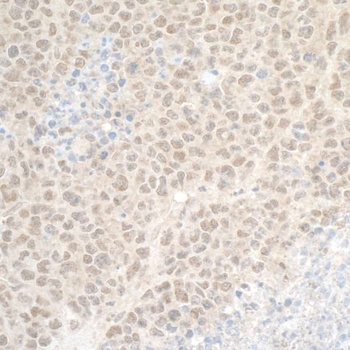 DTL/CDT2 Antibody