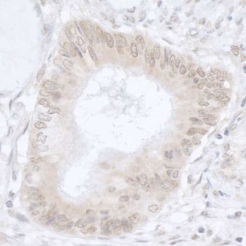 Rabbit anti-USP36/DUB1 Antibody