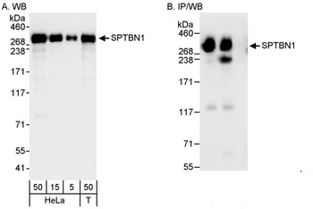 SPTBN1 Antibody