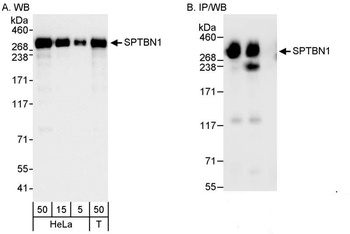 Rabbit anti-SPTBN1 Antibody
