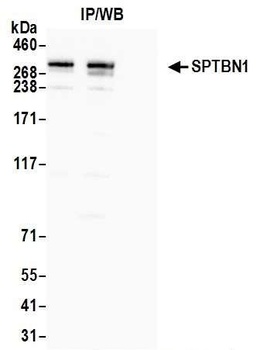 Rabbit anti-SPTBN1 Antibody