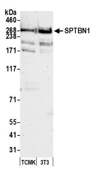 Rabbit anti-SPTBN1 Antibody
