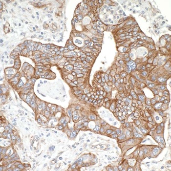 Rabbit anti-SPTBN1 Antibody