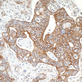 SPTBN1 Antibody