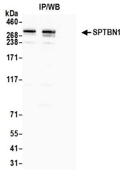 SPTBN1 Antibody