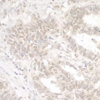 G9A/EHMT2 Antibody