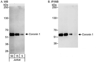 Rabbit anti-Coronin 1 Antibody