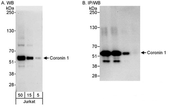 Rabbit anti-Coronin 1 Antibody