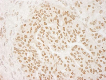 Rabbit anti-PRMT6 Antibody