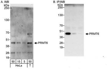 Rabbit anti-PRMT6 Antibody