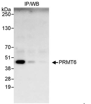Rabbit anti-PRMT6 Antibody