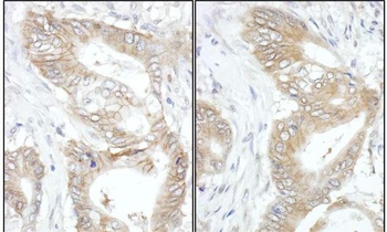 Rabbit anti-USP14 Antibody